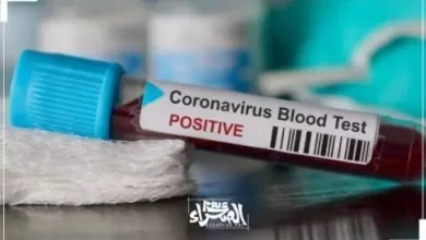 صورة موريتانيا: تسجيل إصابة واحدة بكورونا و4 حالات شفاء