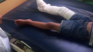 صورة أركيز: طلقات نارية في مناسبة اجتماعية #بملك لمراير” تصيب طفلا إصابة بالغة (خاص)