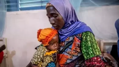 صورة يونسيف: سوء التغذية يهدد حوالي مليون طفل في منطقة الساحل