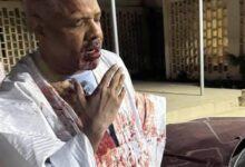 صورة الصحفي حنفي ولد دهاه يتعرض لاعتداء أمام مقر عمله من مجهولين