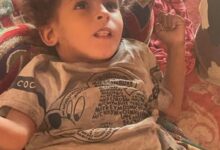 صورة نداء إنساني: طفلة من مدينة كرو تواجه الفقر والمرض وتحتاج لدعمكم