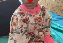 صورة رئيسة المرصد الوطني لحقوق المرأة والفتاة تعلن تحسن حالة الطفلة المعنفة وجهود حكومية لدعمها
